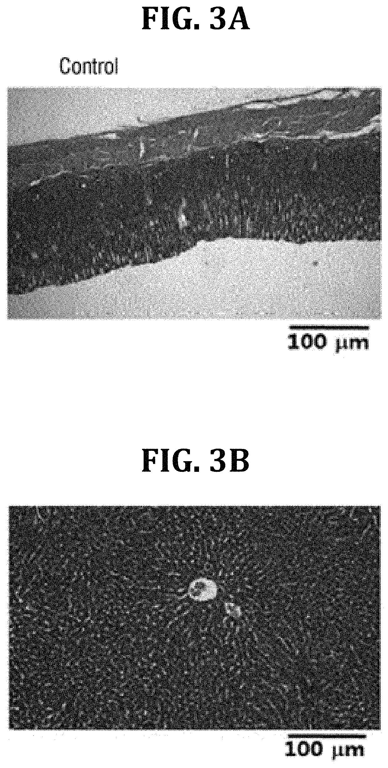 Composition containing <i>Dolichos lablab </i>Linn. extract as active ingredient for easing hangovers, and preventing, alleviating or treating alcoholic gastrointestinal diseases