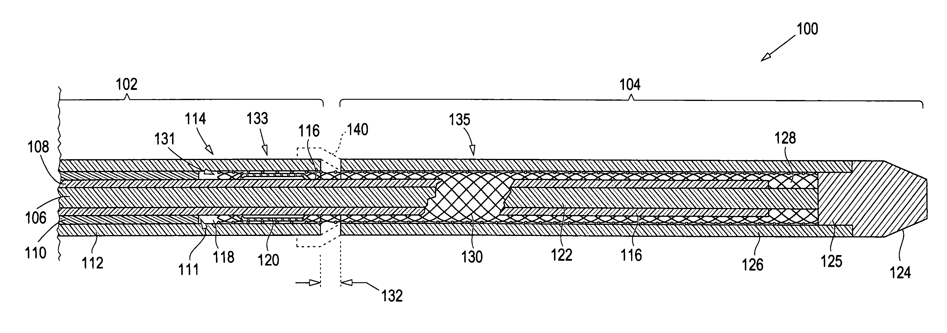 Method and apparatus for deployment of an endoluminal device