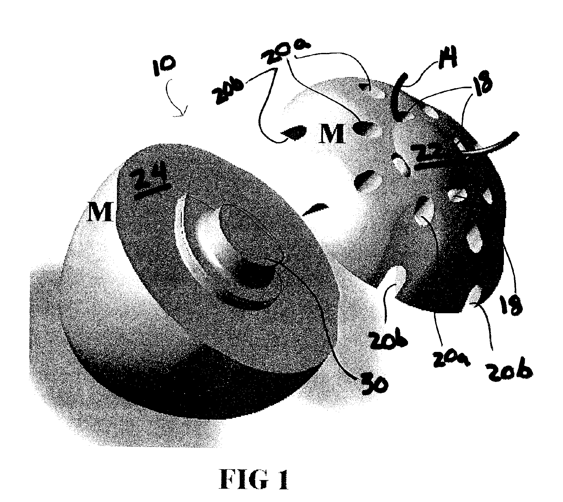 Quasi-spherical orbital implant