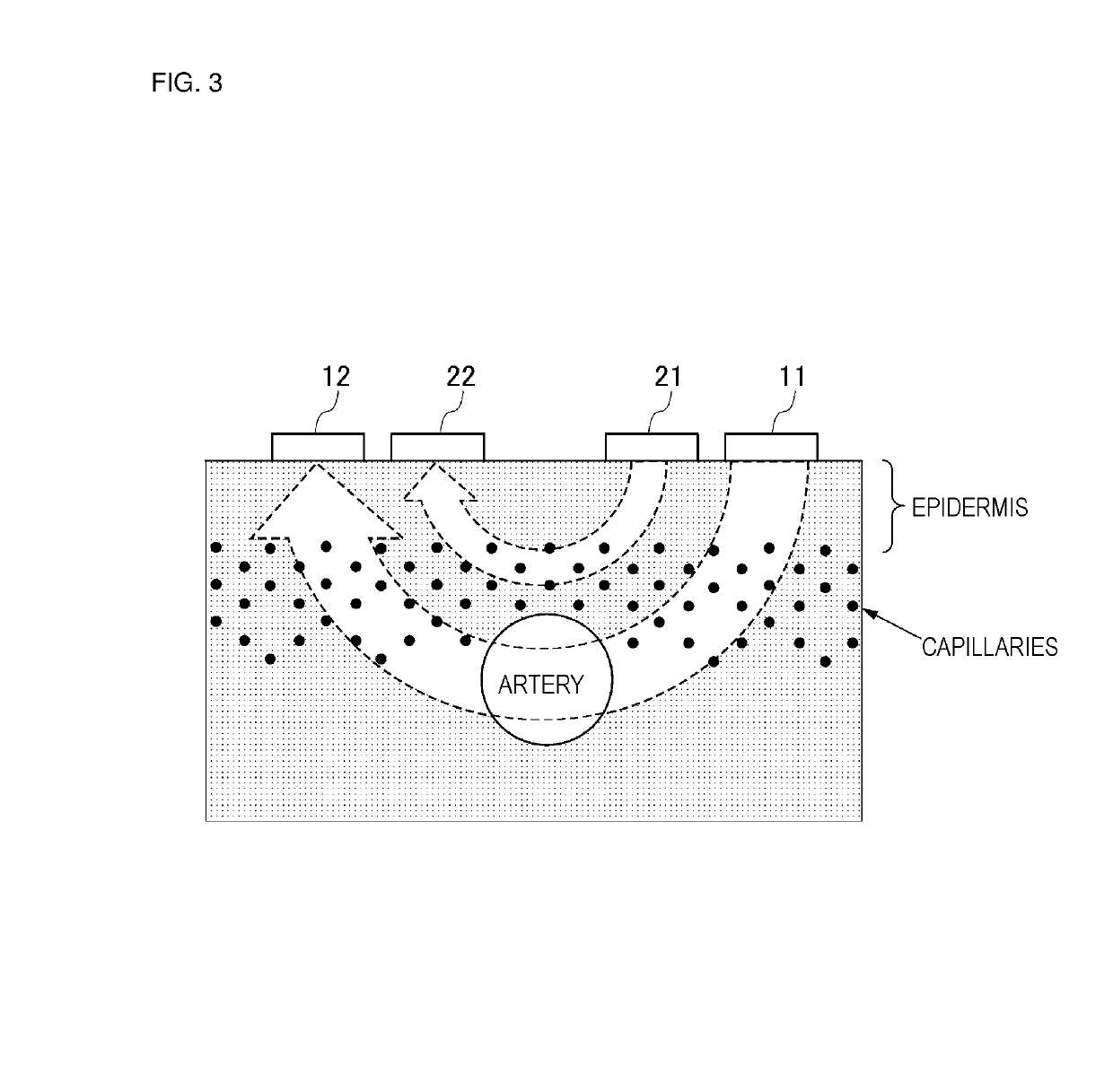 Pulse transmission time measuring apparatus and biological state estimating apparatus