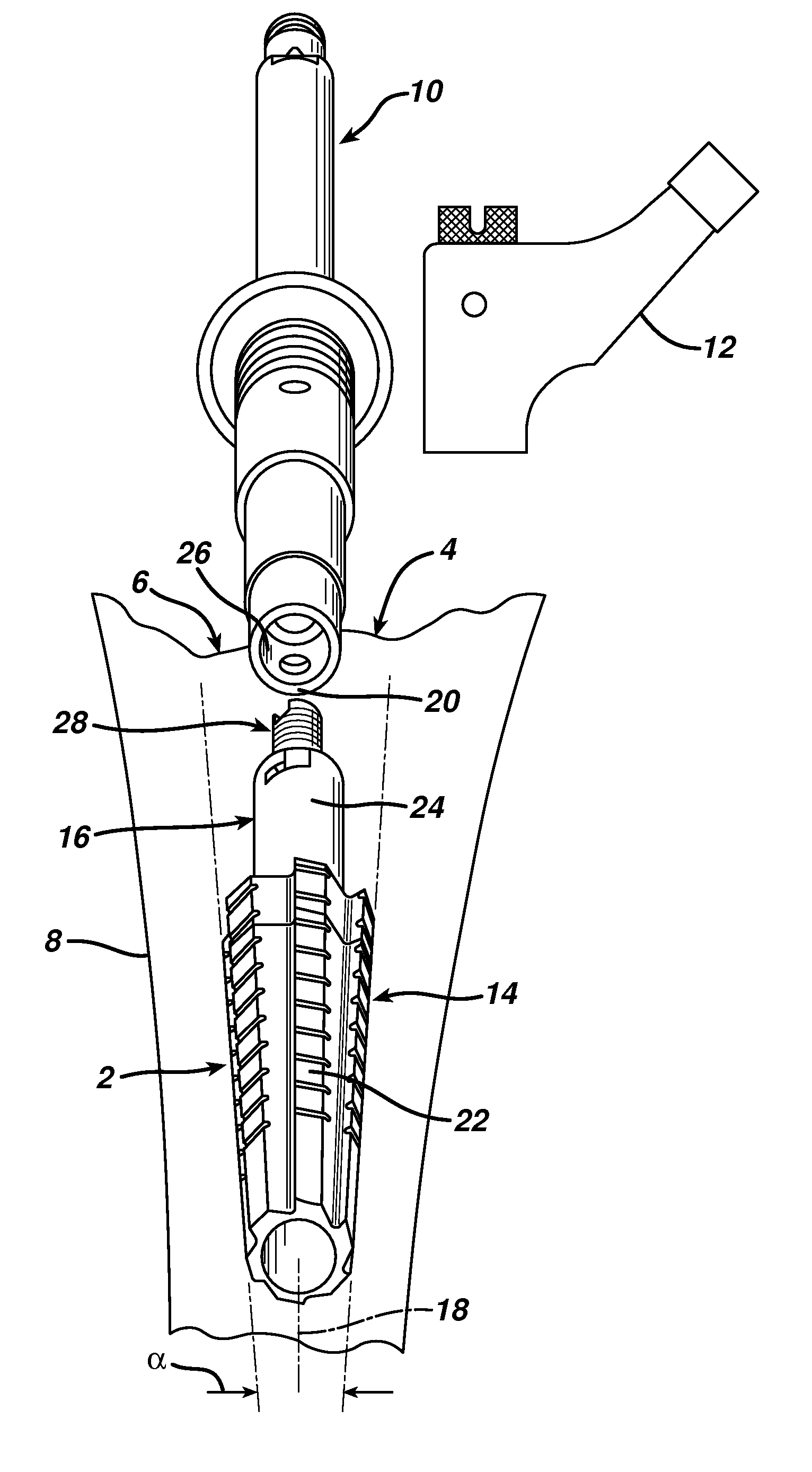 Modular tapered reamer for bone preparation and associated method