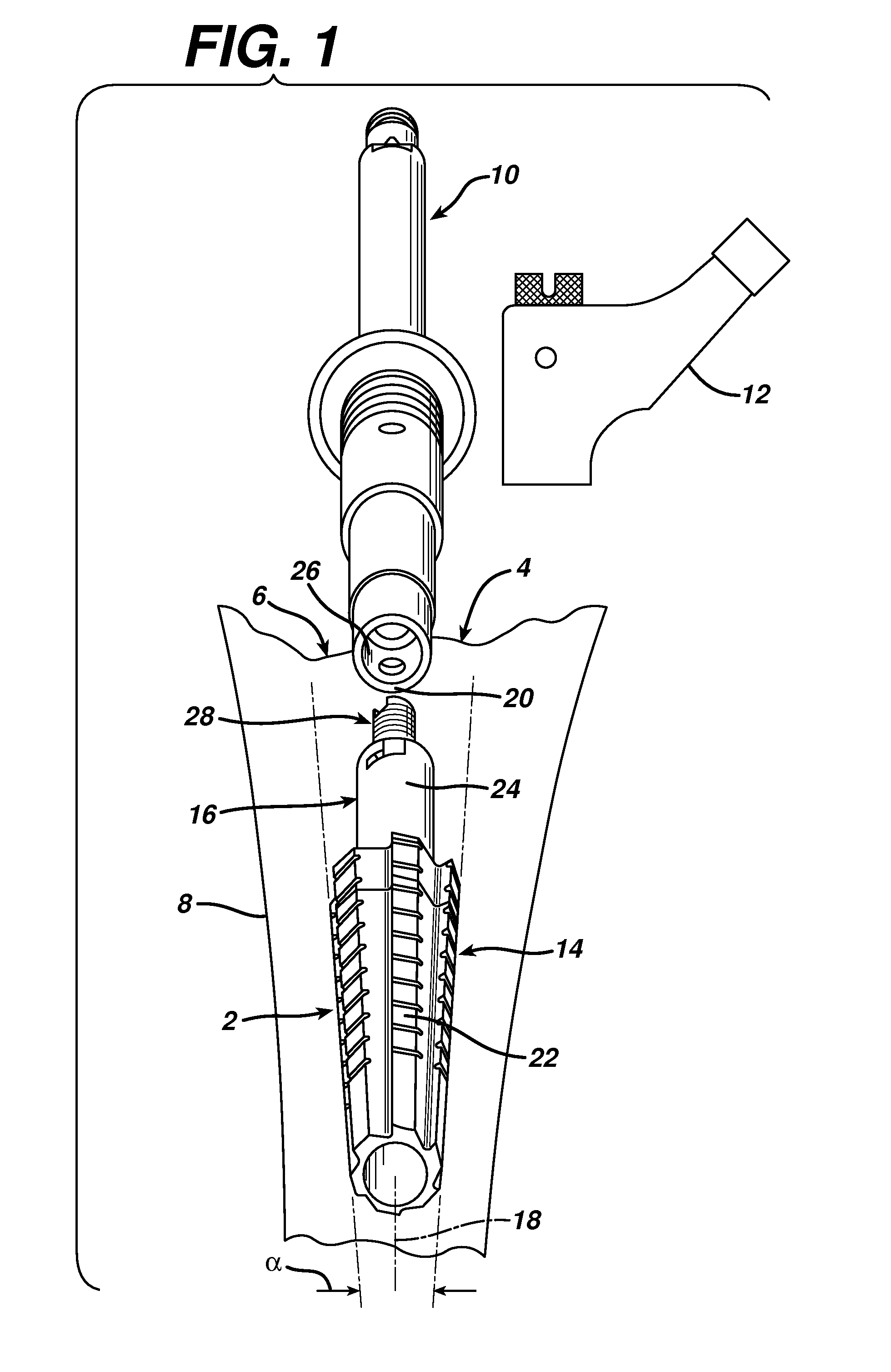 Modular tapered reamer for bone preparation and associated method