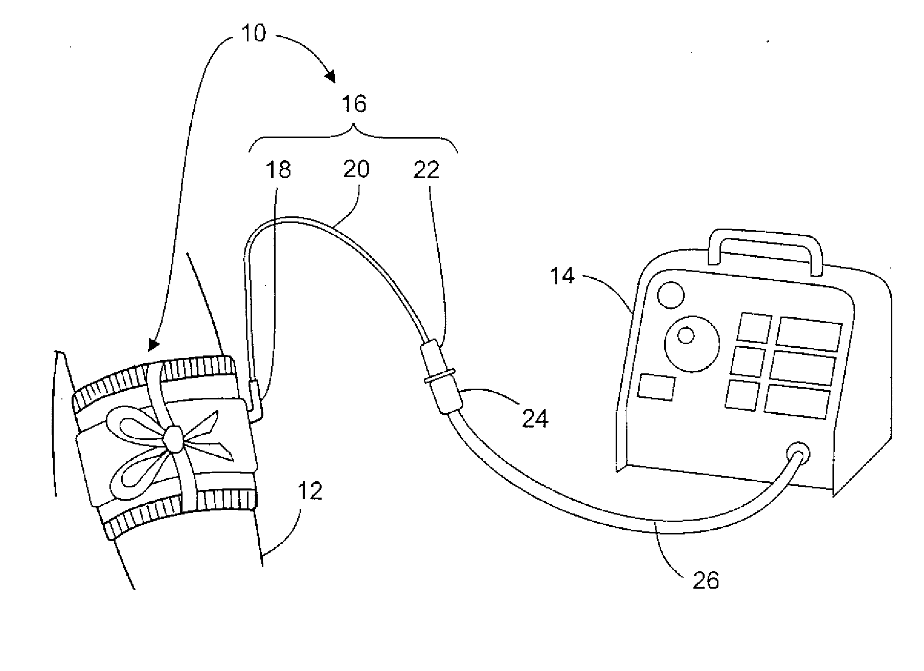 Manufacture and Use of Tourniquet Cuff with Improved Pneumatic Passageway