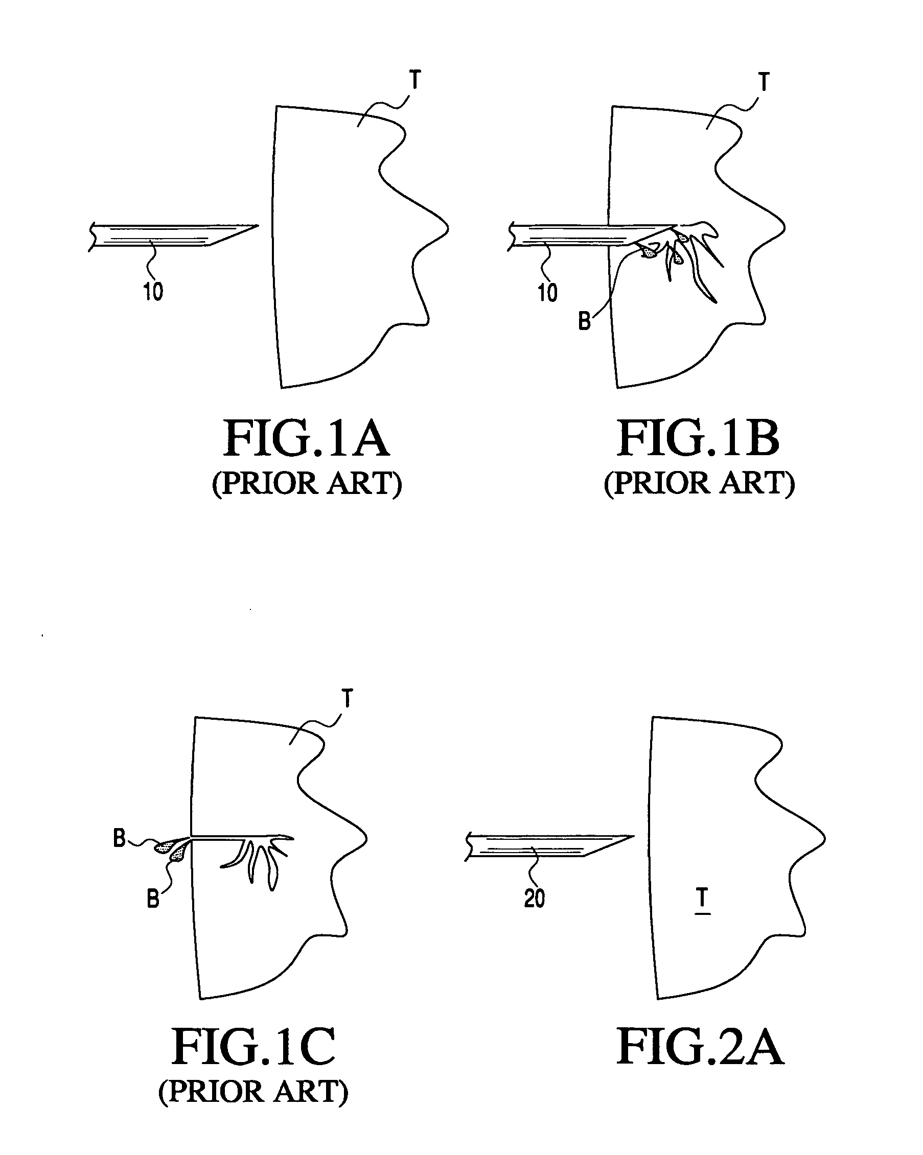 Apparatus and methods for treating tissue using passive injection systems