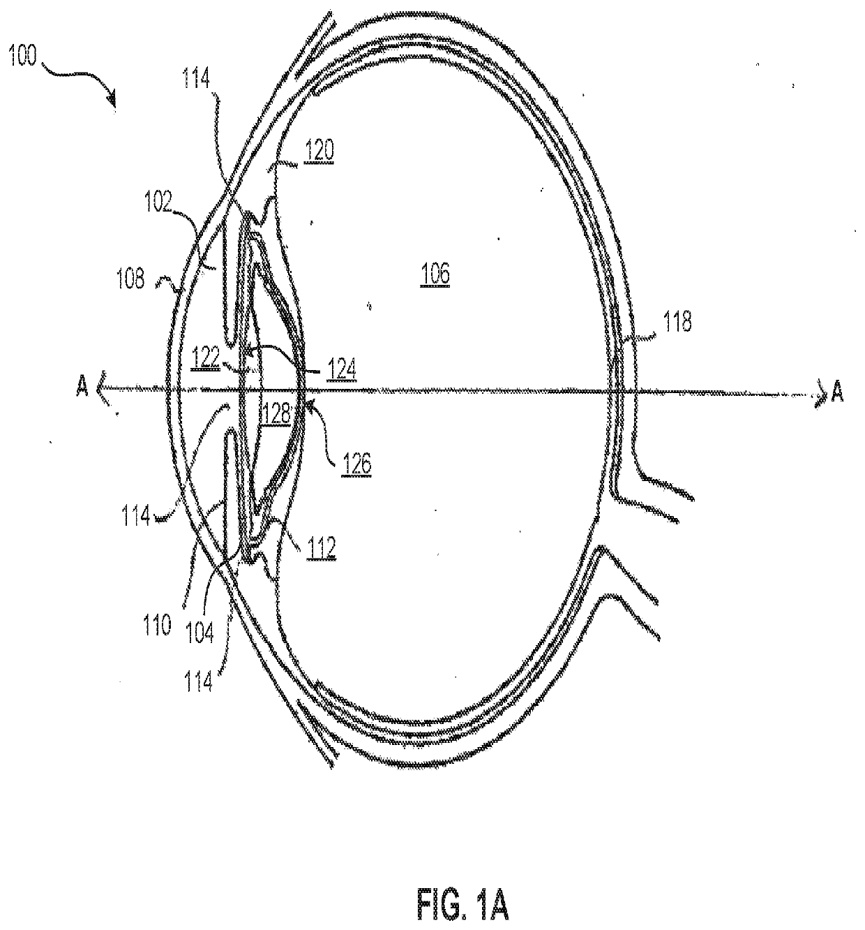 Lens oil having a narrow molecular weight distribution for intraocular lens devices