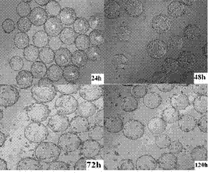 Infectious bursal disease virus Vero cell-adapted strain and application thereof