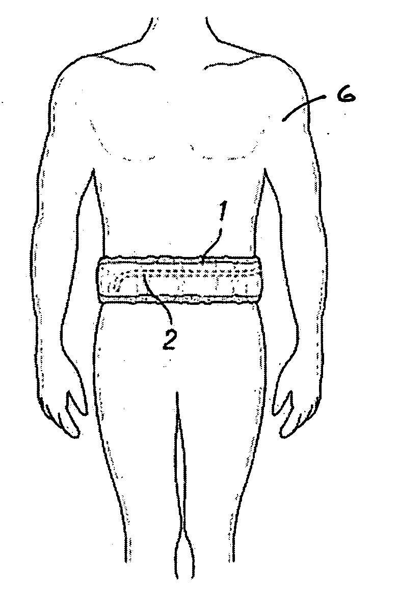 Peritoneal catheter support garment