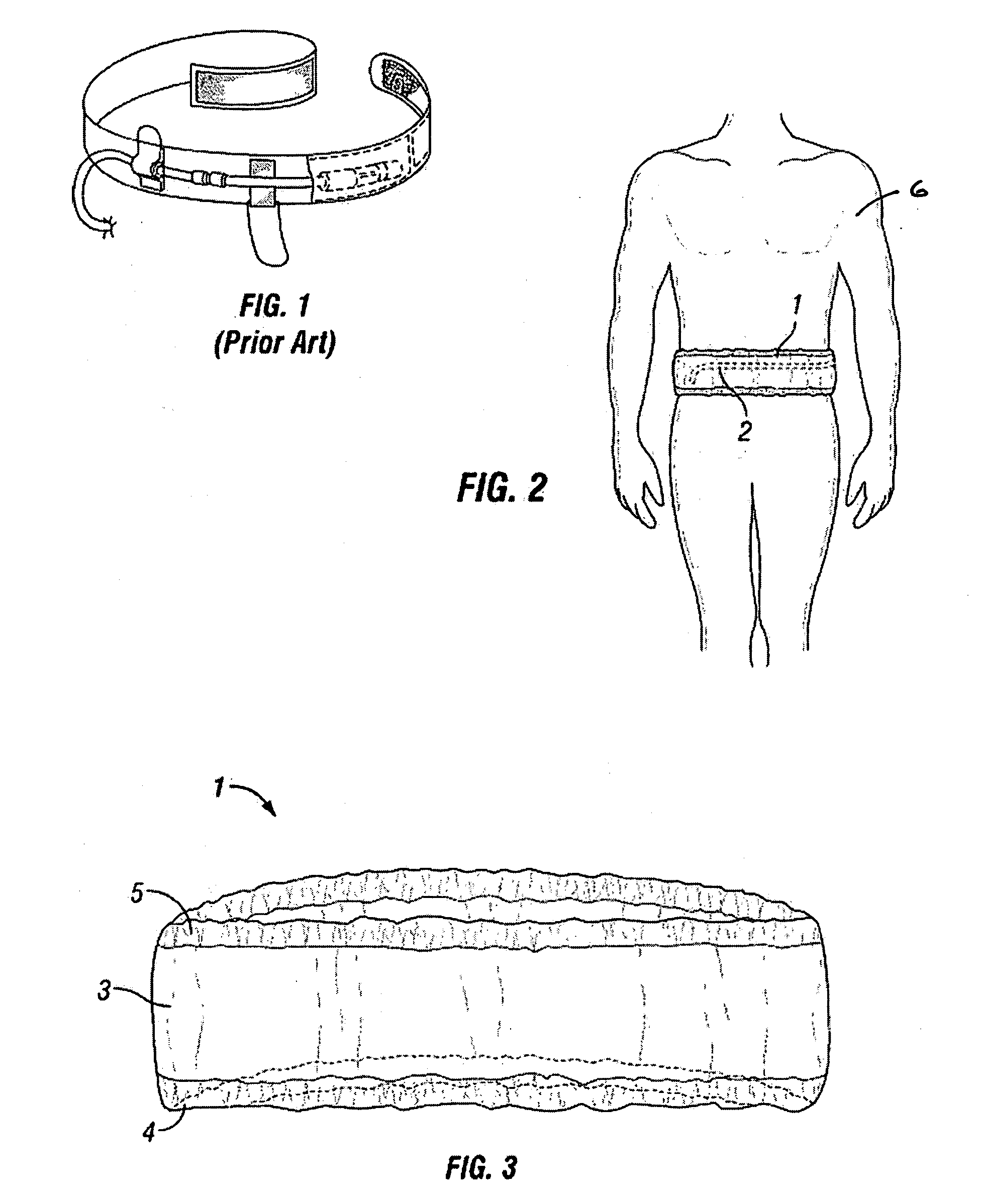 Peritoneal catheter support garment