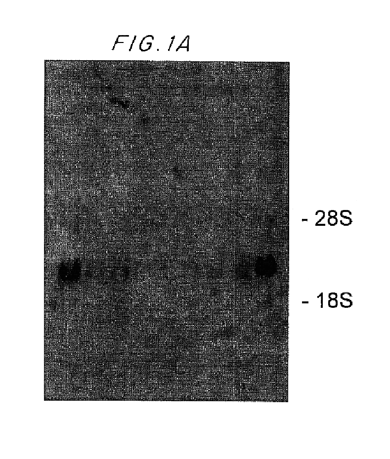 Intracellular glucocorticoid-induced leucine zippers modulators of apoptic cell death pathways