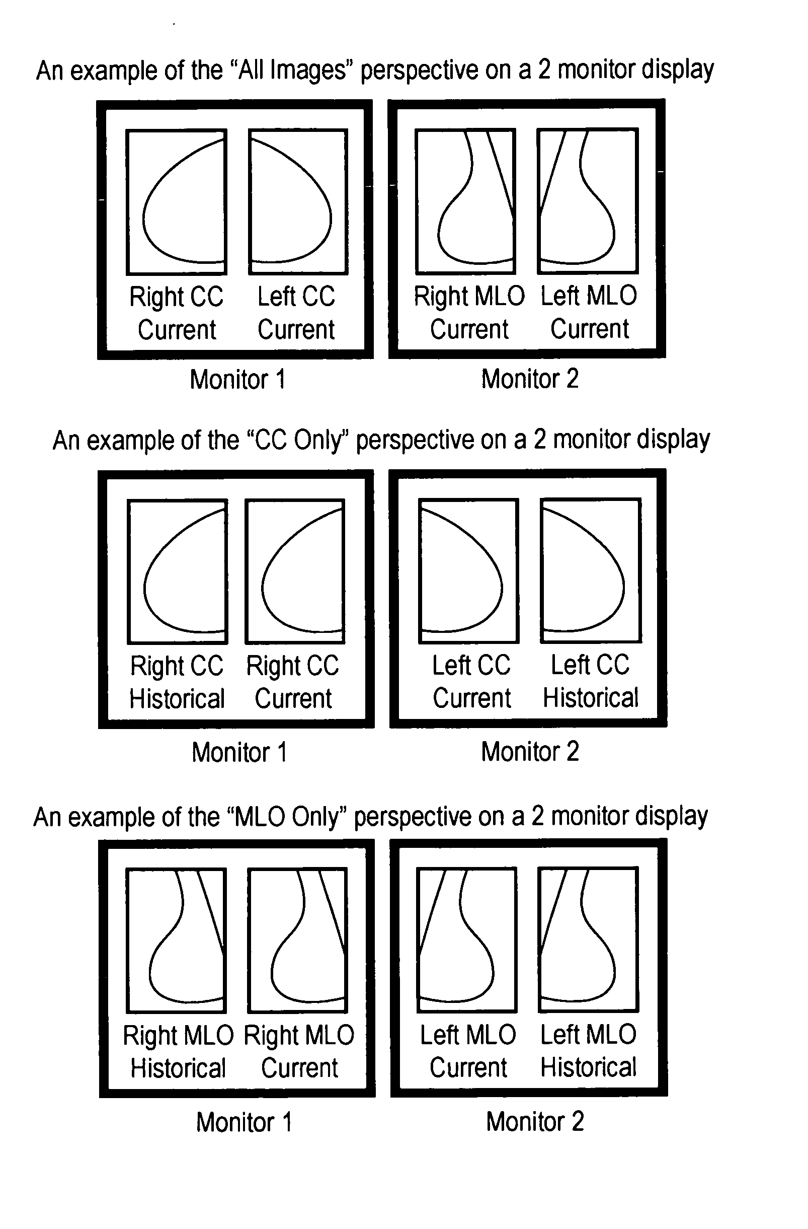 System and method for displaying image studies using hanging protocols with perspectives/views