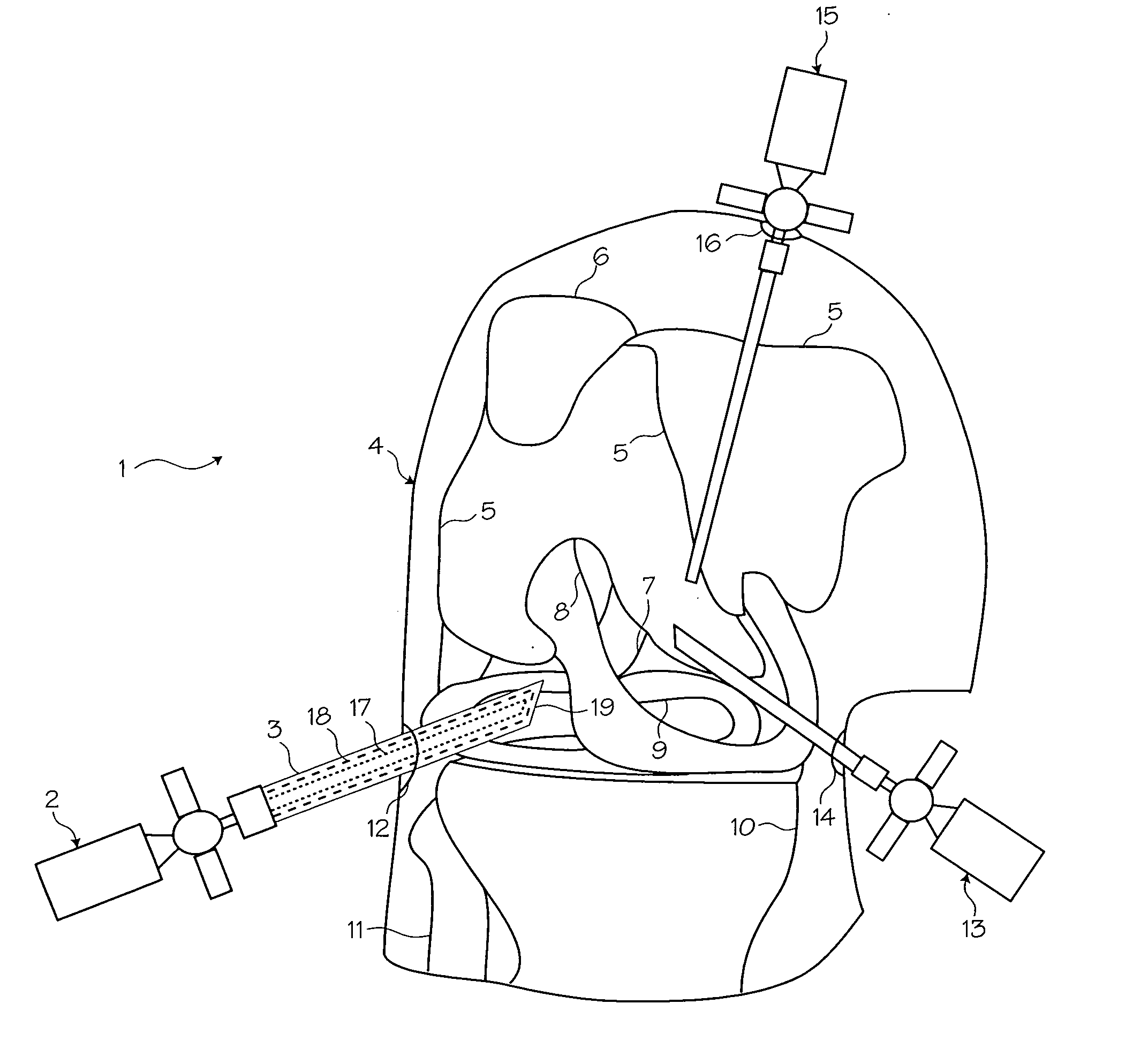 Atraumatic arthroscopic instrument sheath