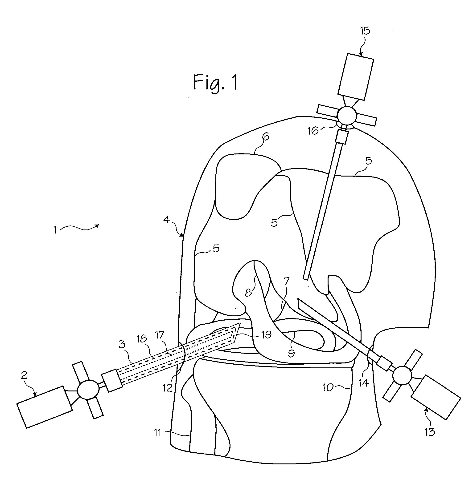 Atraumatic arthroscopic instrument sheath