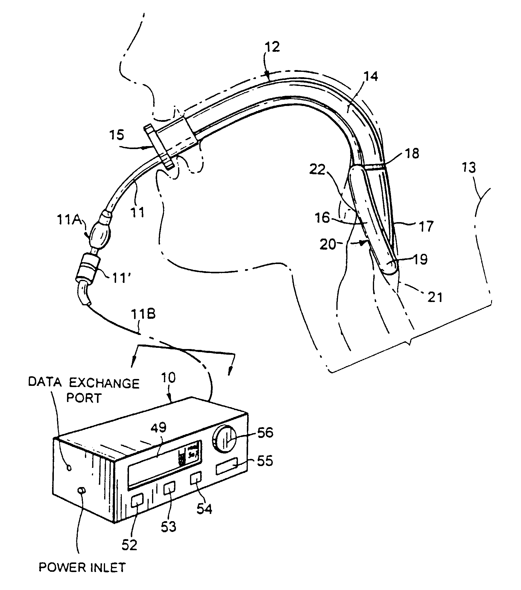 Monitoring and control for a laryngeal mask airway device