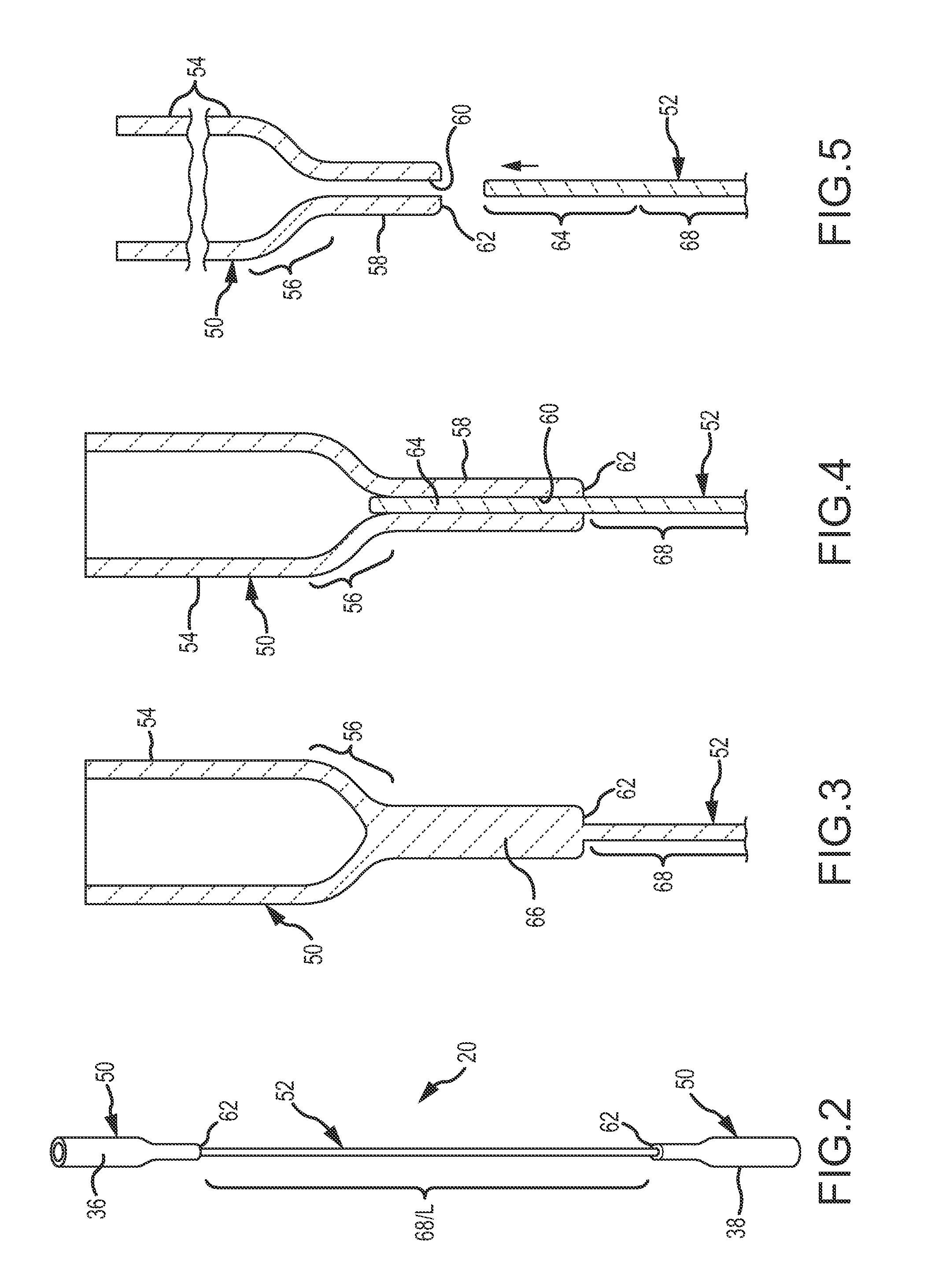 Pendulum Arm Flexure and Method of Construction