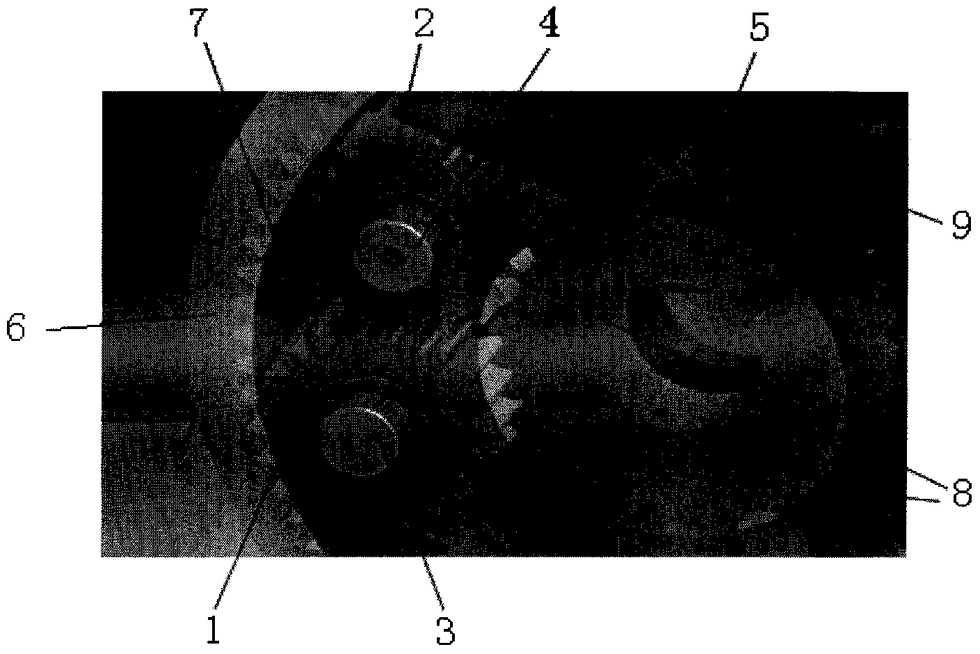 Composite planet row structure adapting to high-rotation-speed working condition