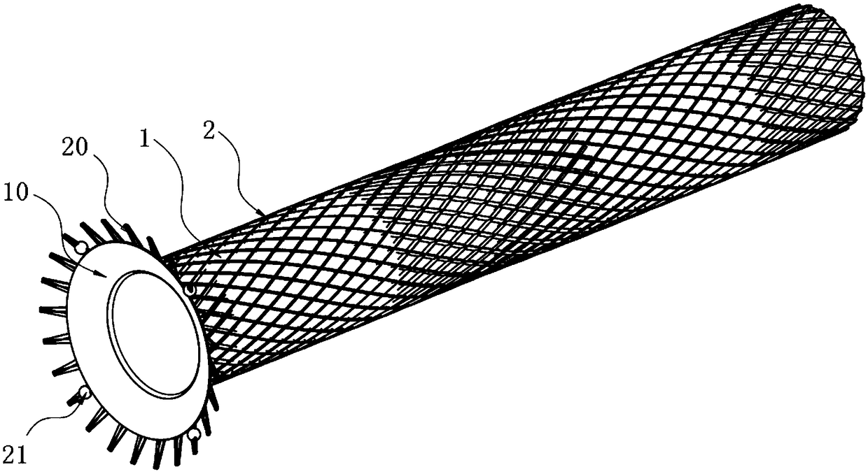 Intrahepatic portosystemic shunt stent