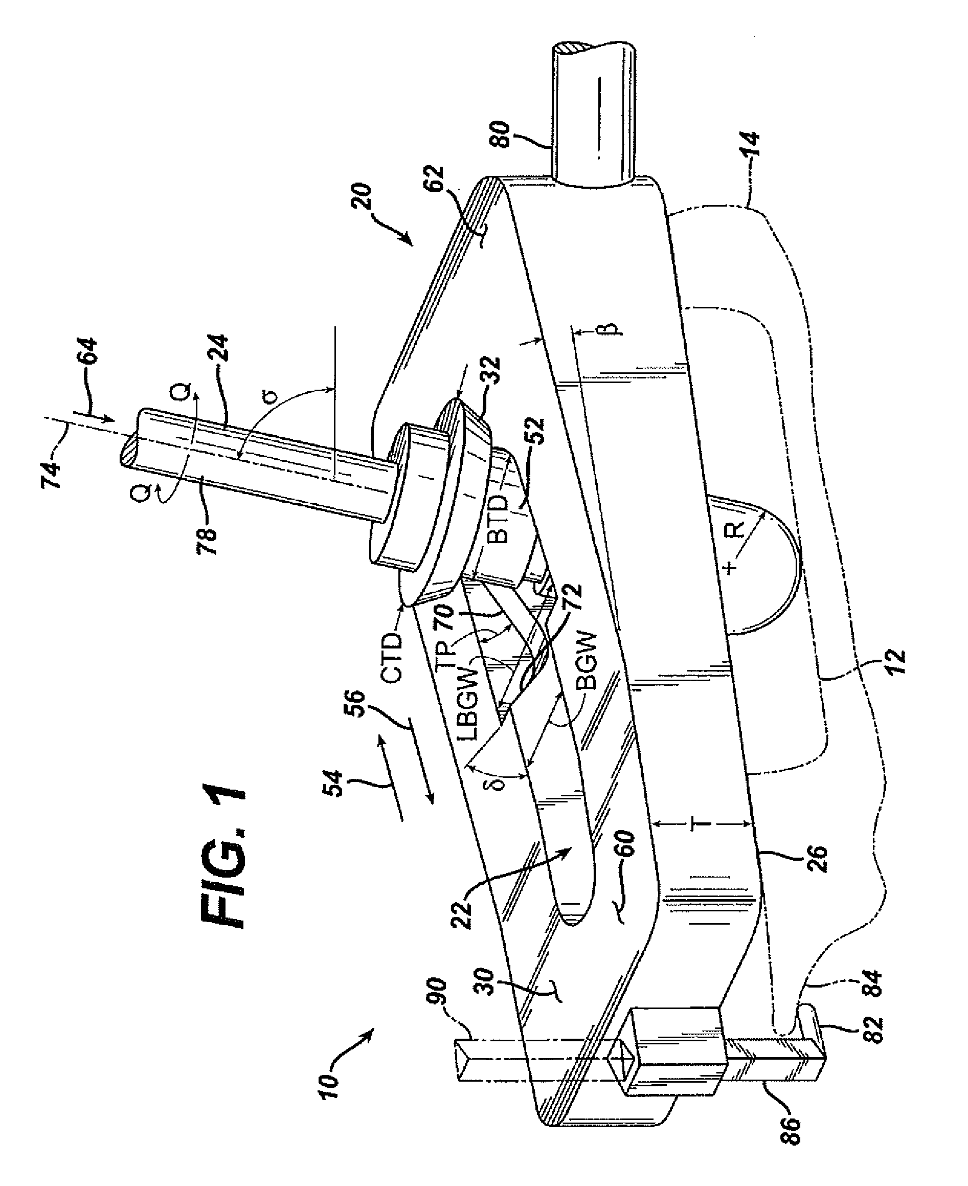 Method for Removal of Bone