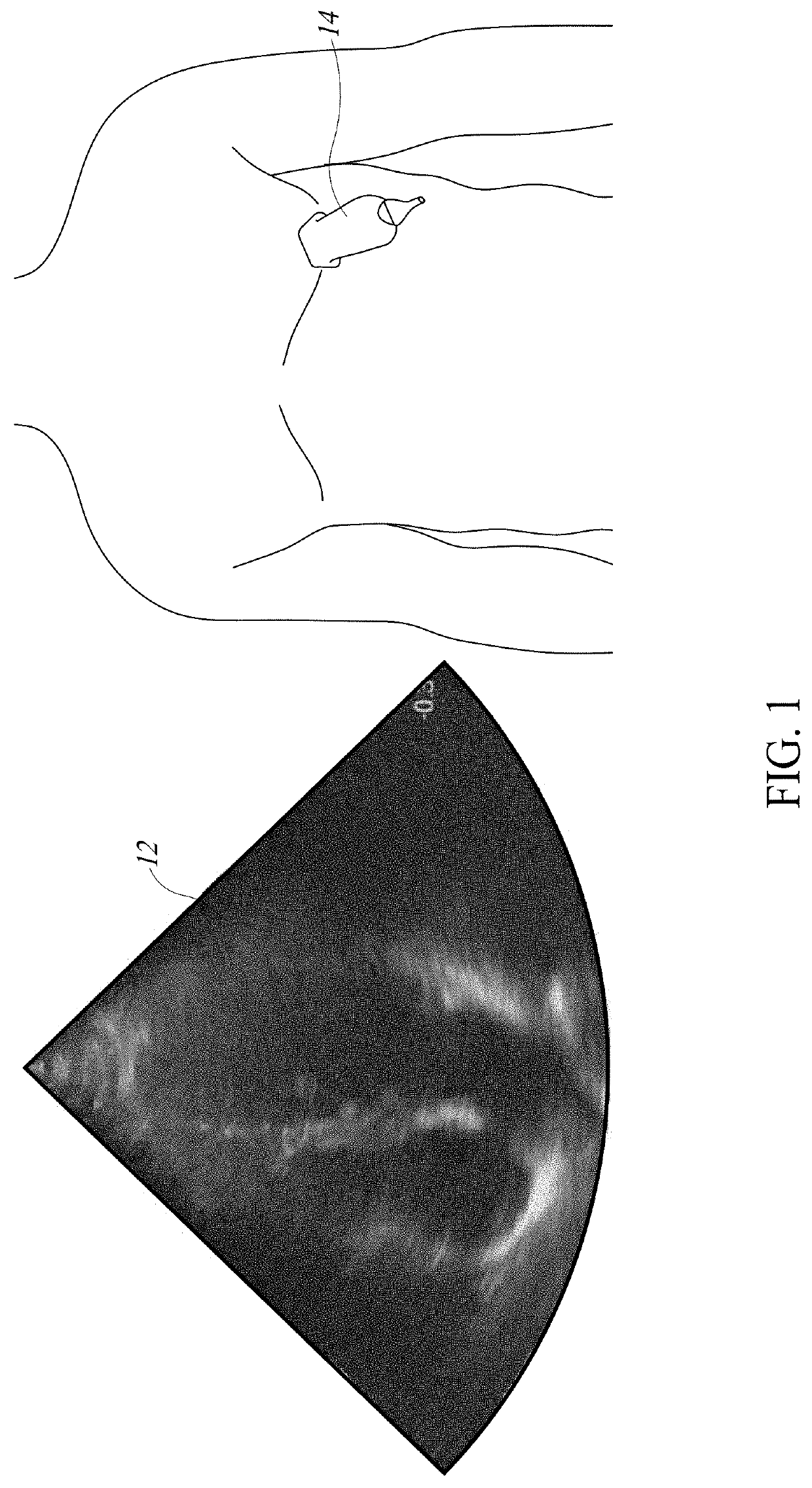 System and method for orientating capture of ultrasound images