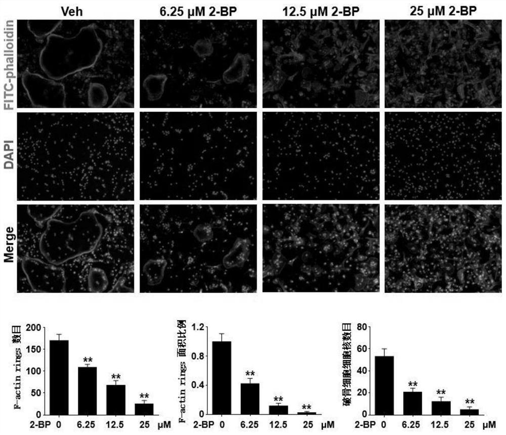 Application of 2-bromopalmitate in preparation of drugs for prevention and treatment of bone loss related diseases