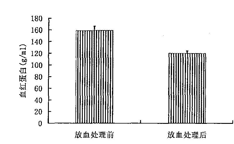 Medicine application of iron liposome