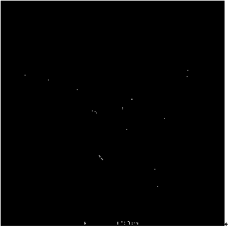 Preparation method of pH responsive mesoporous silica nano-drug carrier for three-in-one therapy