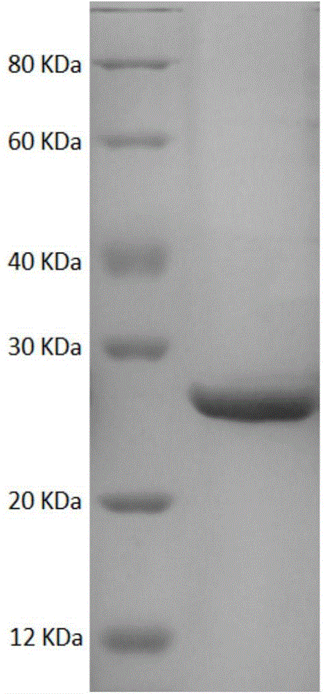 Recombinant escherichia coli for preparing (S)-4-chlorine-3-hydroxyl ethyl butyrate by adopting asymmetric transformation and application of recombinant escherichia coli