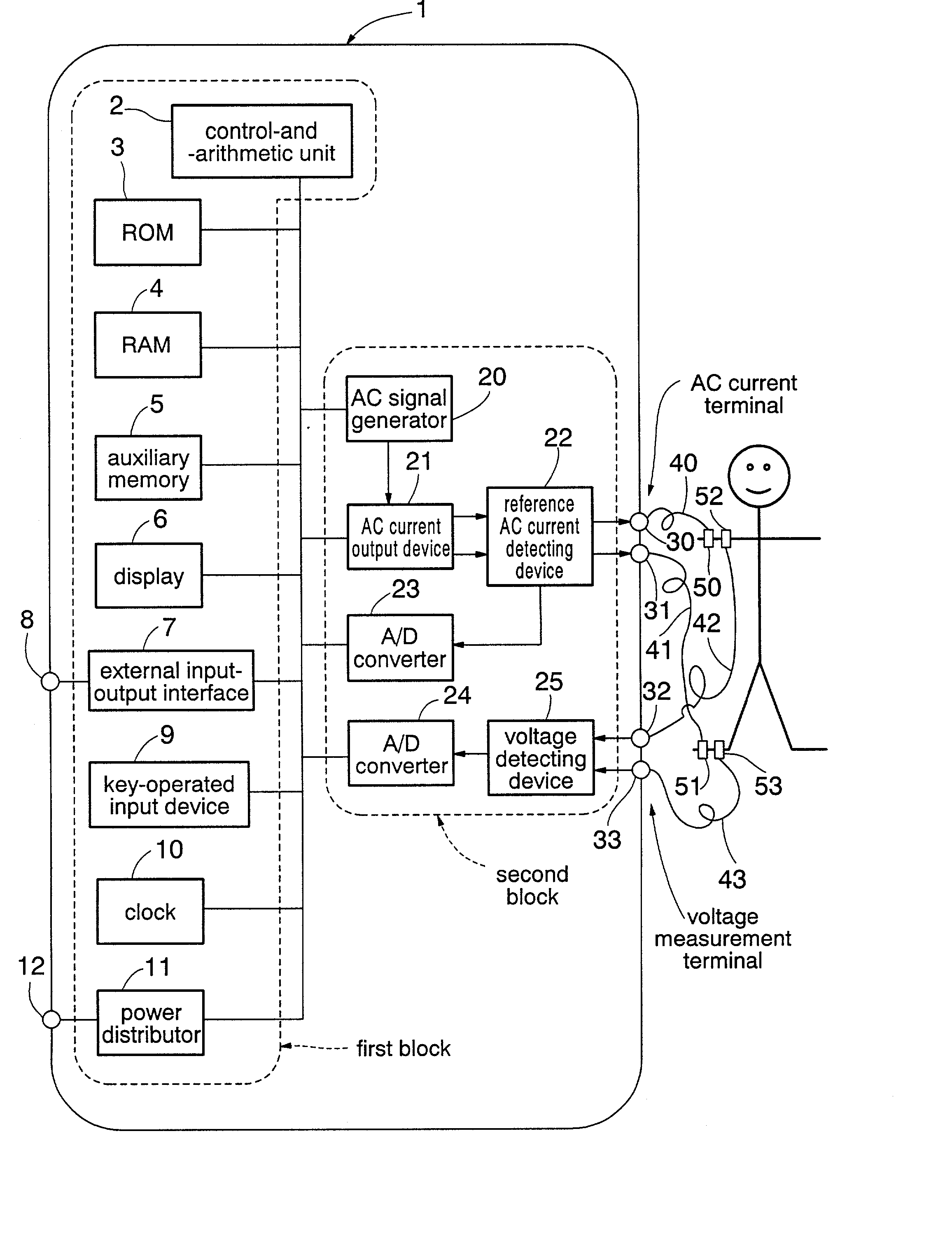 Body water amount condition judging apparatus by multi-frequency bioelectric impedance measurement