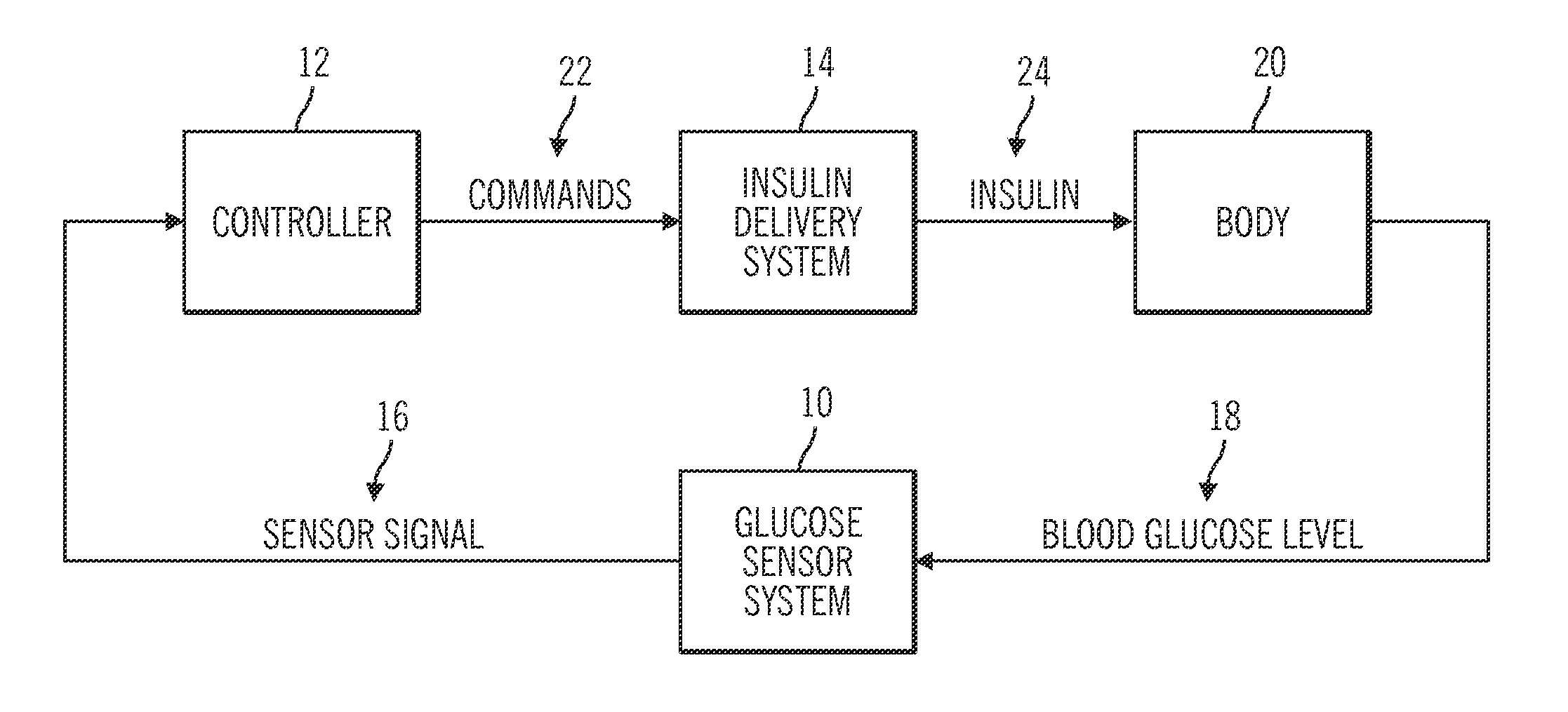 Insulin on board compensation for a closed-loop insulin infusion system