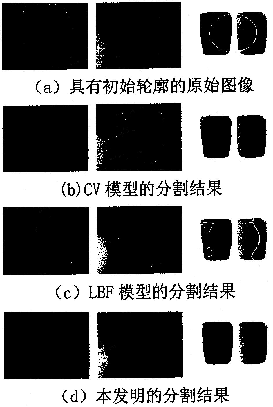 An image segmentation method based on local energy functional and non-convex regular term combined with local entropy