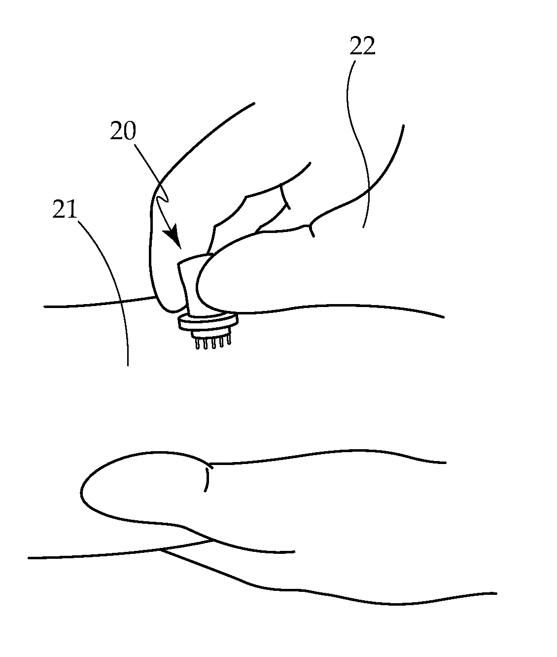 Borrelia Provocation Procedure Kit