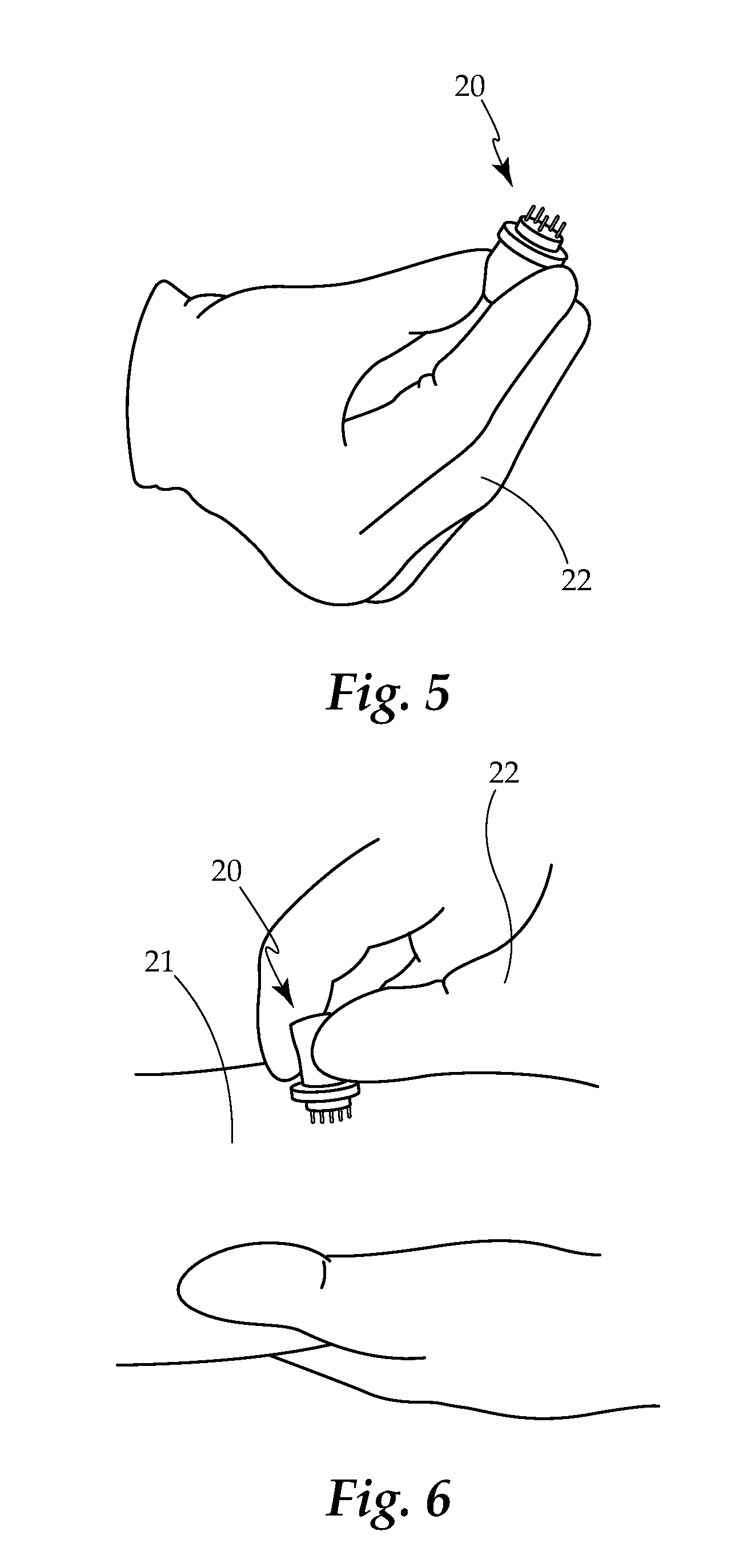 Borrelia Provocation Procedure Kit