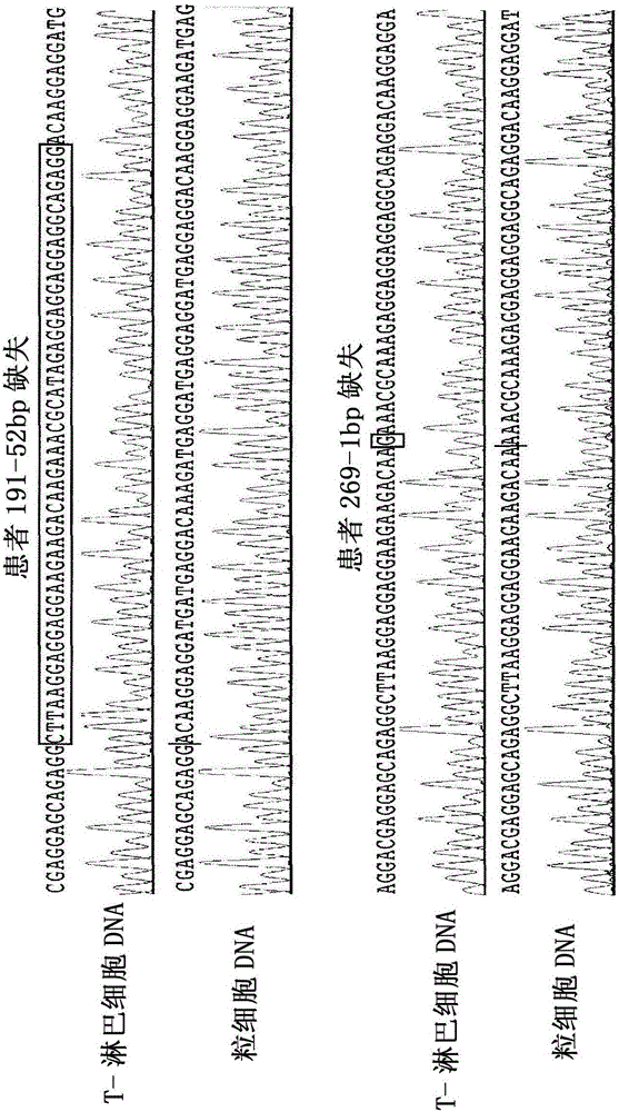 Mutant calreticulin for the diagnosis of myeloid malignancies