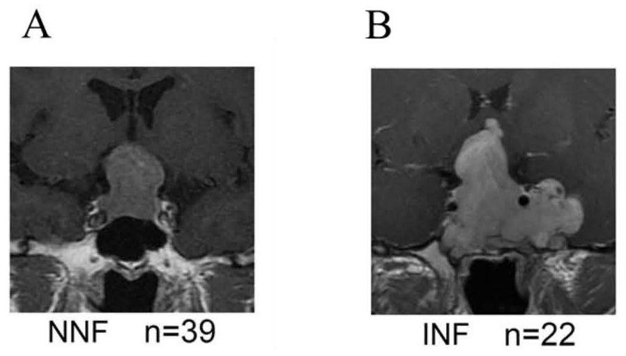 Gene combination for distinguishing non-invasive and invasive non-functional pituitary adenomas