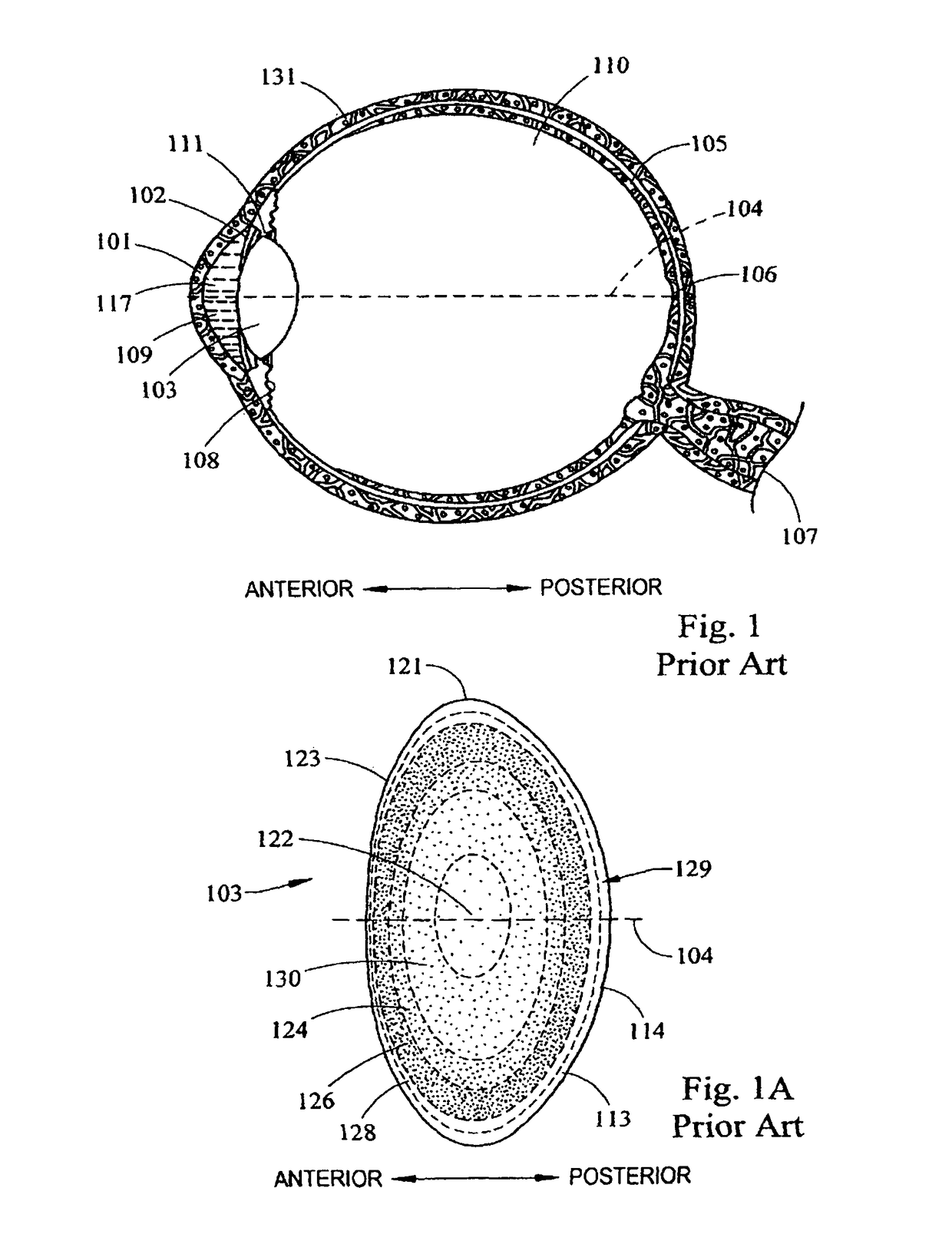 System and apparatus for delivering a laser beam to the lens of an eye