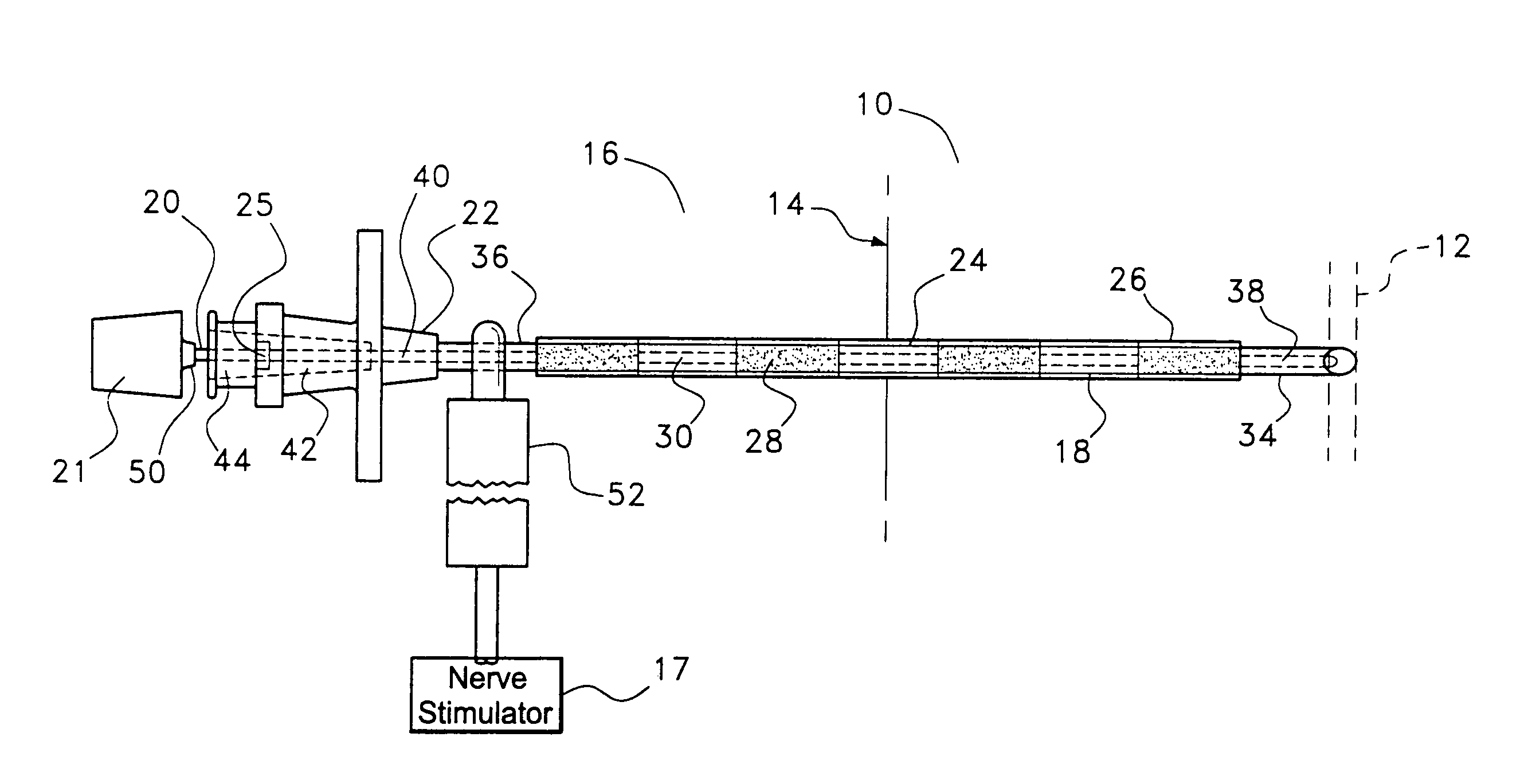 Instrument and method for delivery of anaesthetic drugs