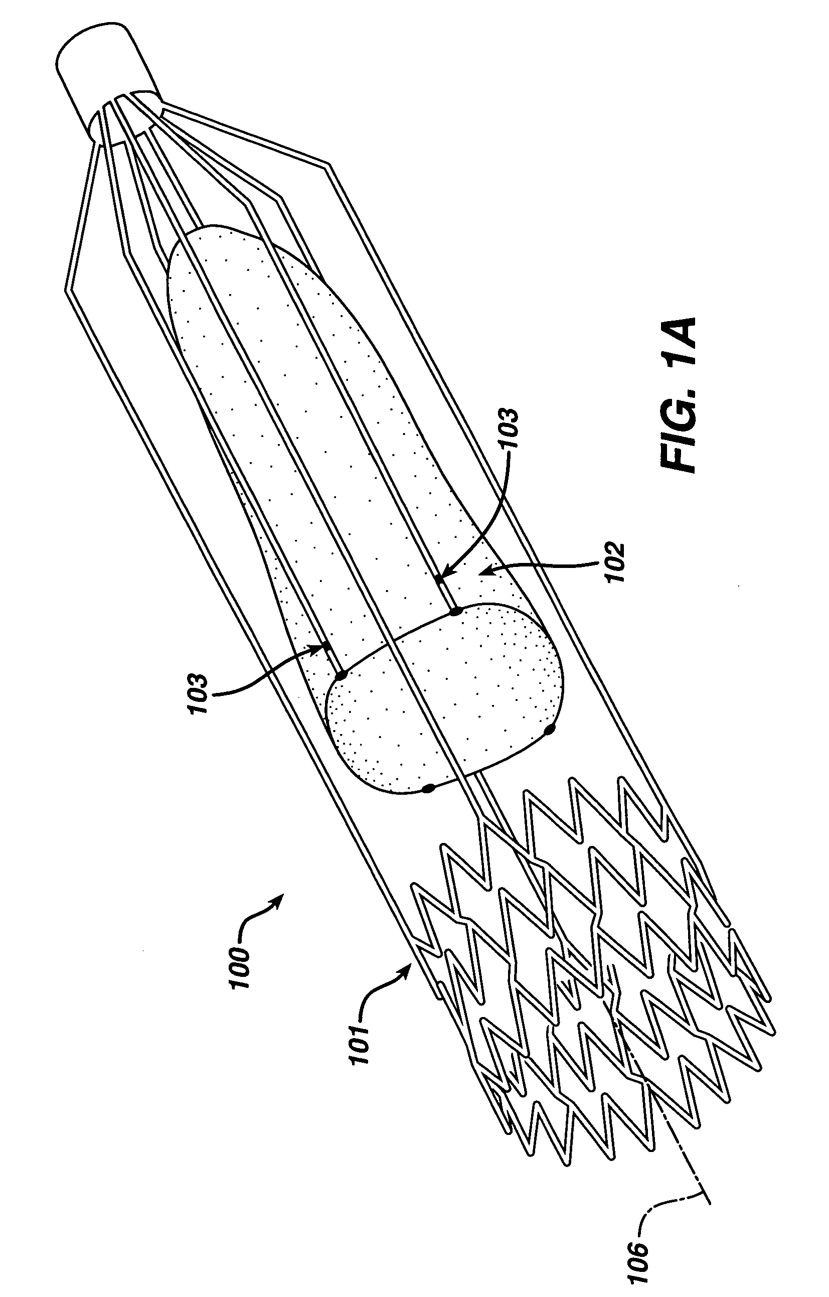 Implantable valvular prosthesis