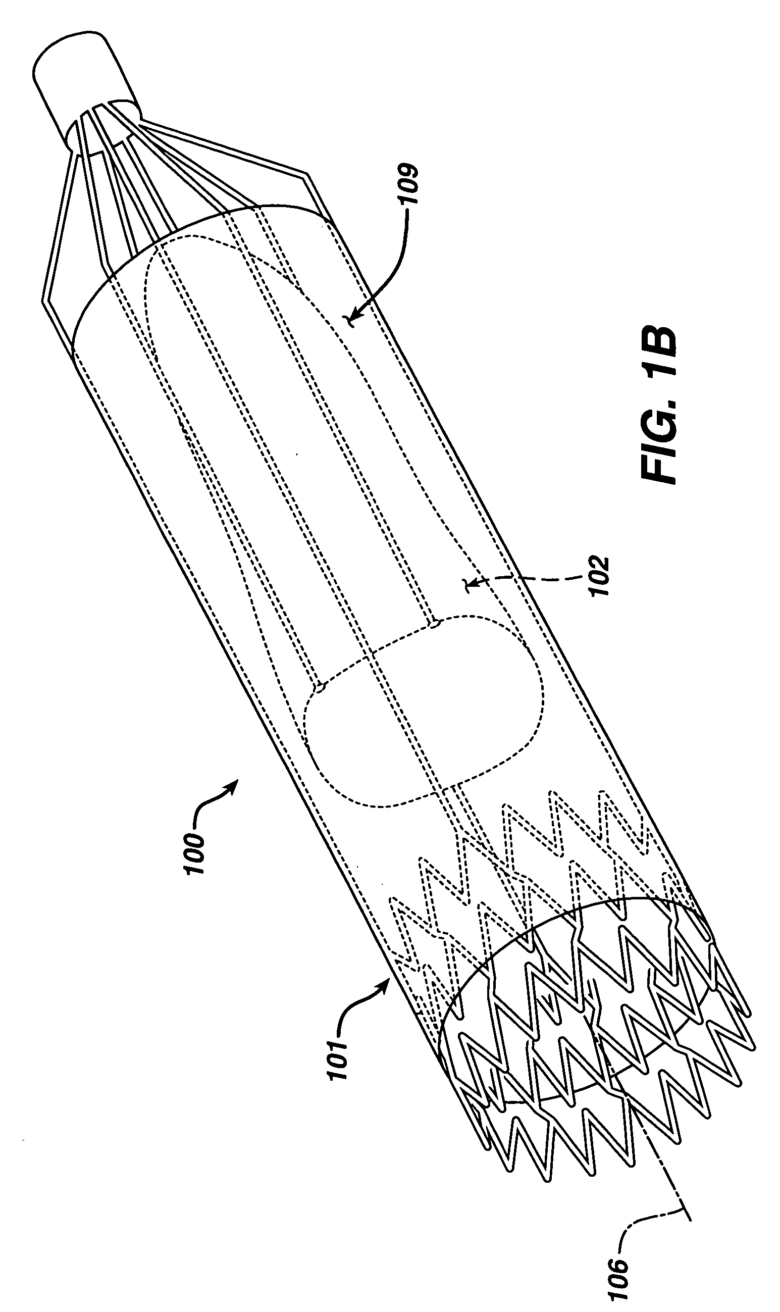 Implantable valvular prosthesis