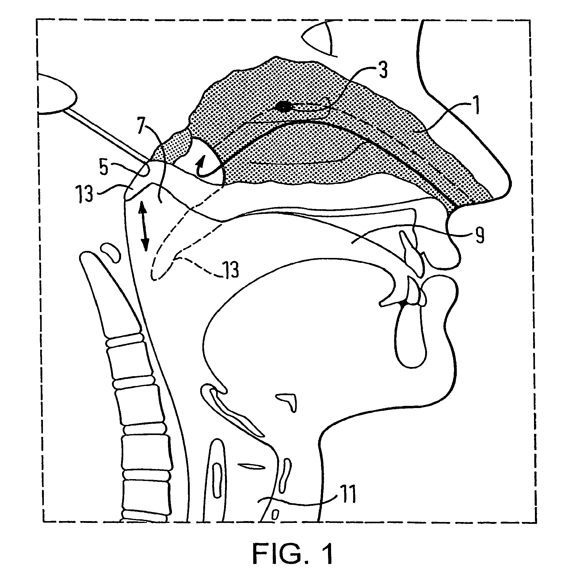 Nasal devices