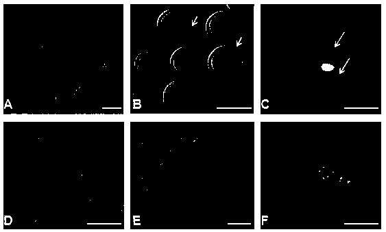 Composition and application for culturing oocytes and skin adult stem cells