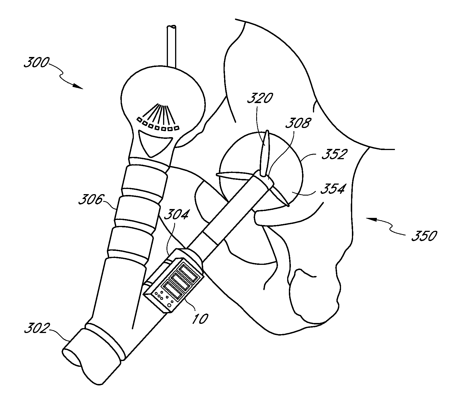 Surgical orientation device and method