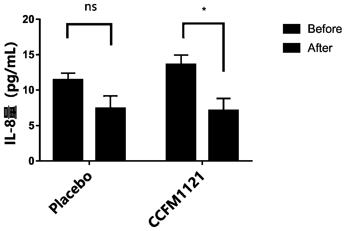 Lactobacillus helveticus capable of inhibiting helicobacter pylori and application of the lactobacillus helveticus