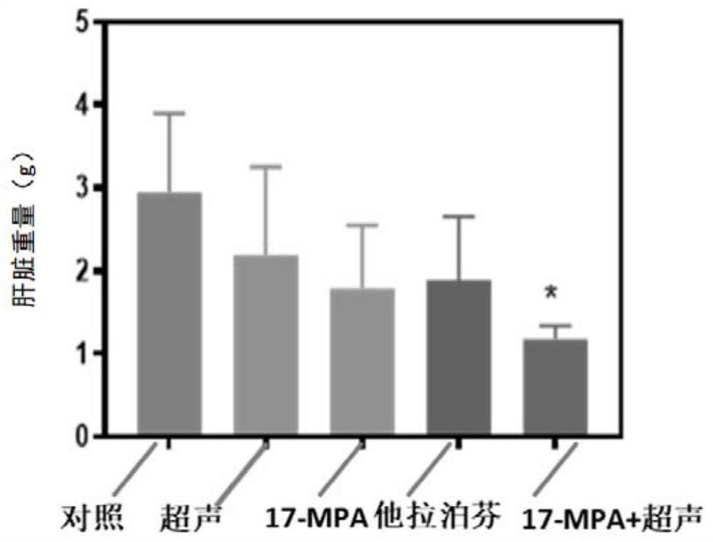 Chlorin derivative, corresponding preparation method and application thereof