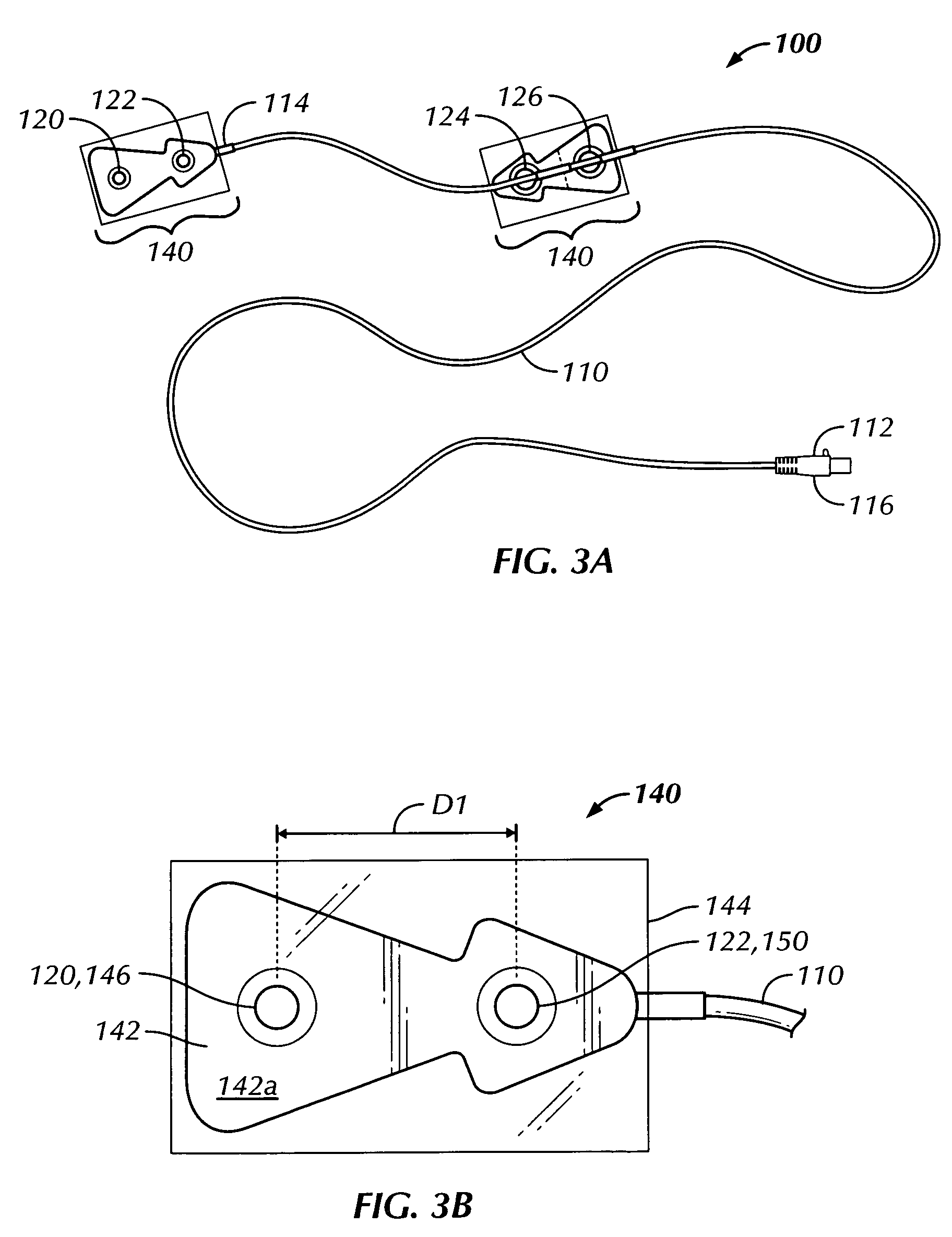 Thoracic impedance monitor and electrode array and method of use