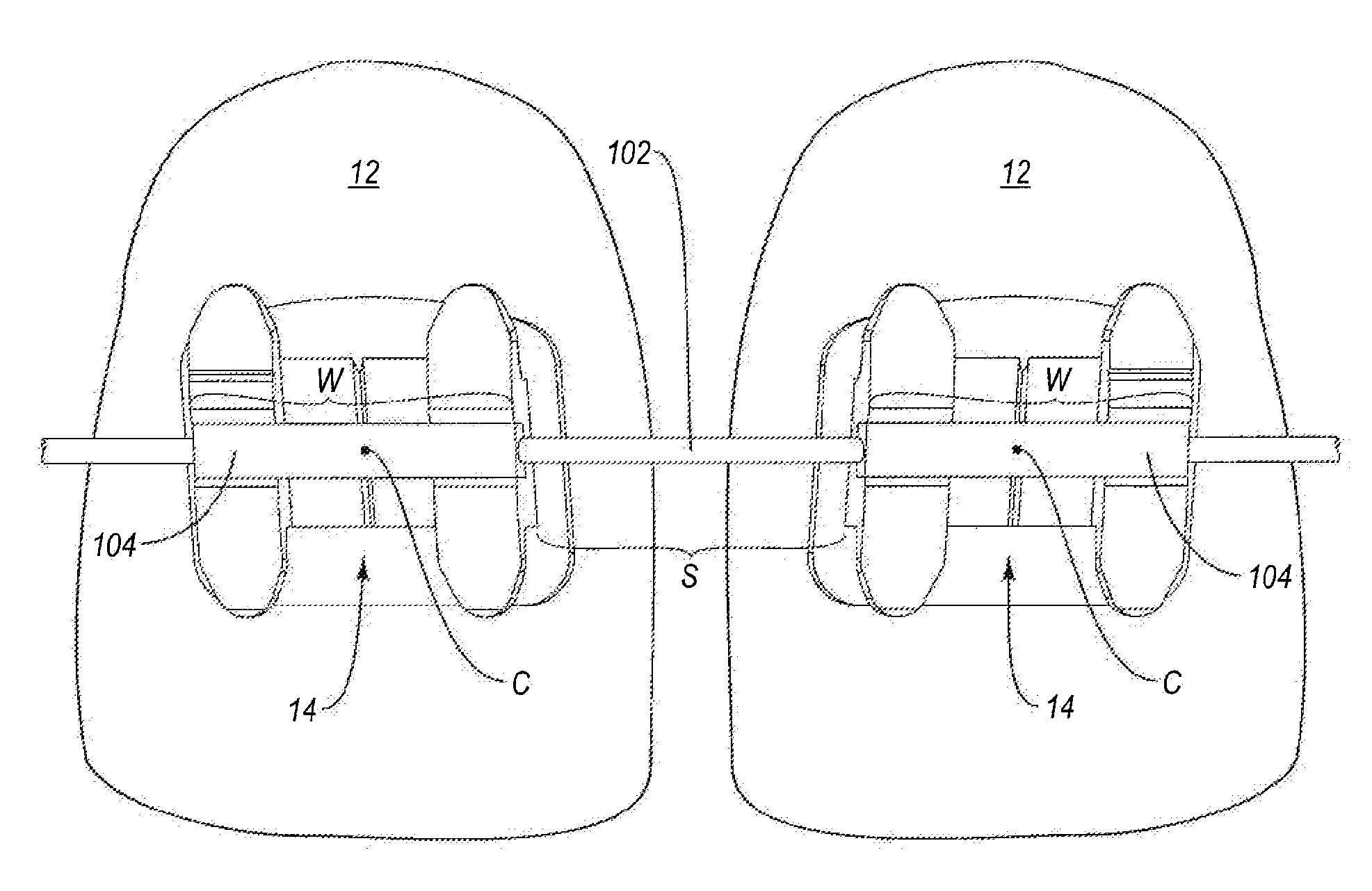 Customized Orthodontic Arch Wire Manufactured Using Model of Patient's Teeth