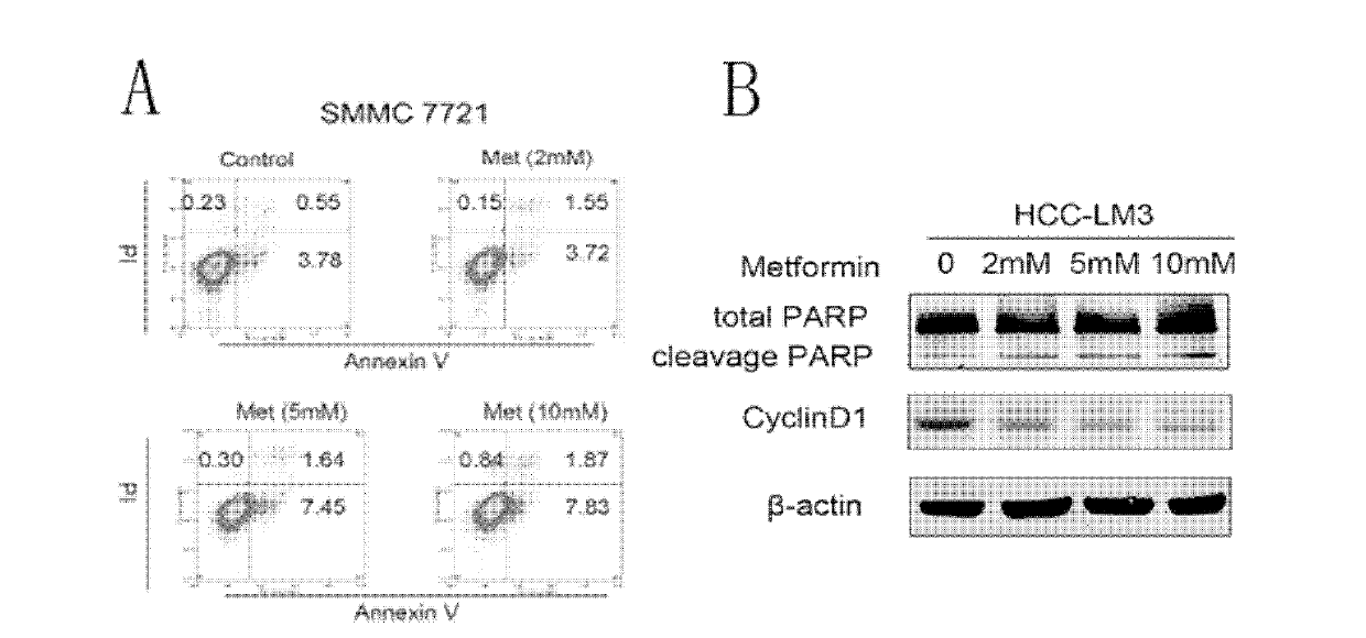 Application of dimethyldiguanide in preparation of medicaments for preventing or treating hepatocellular carcinoma