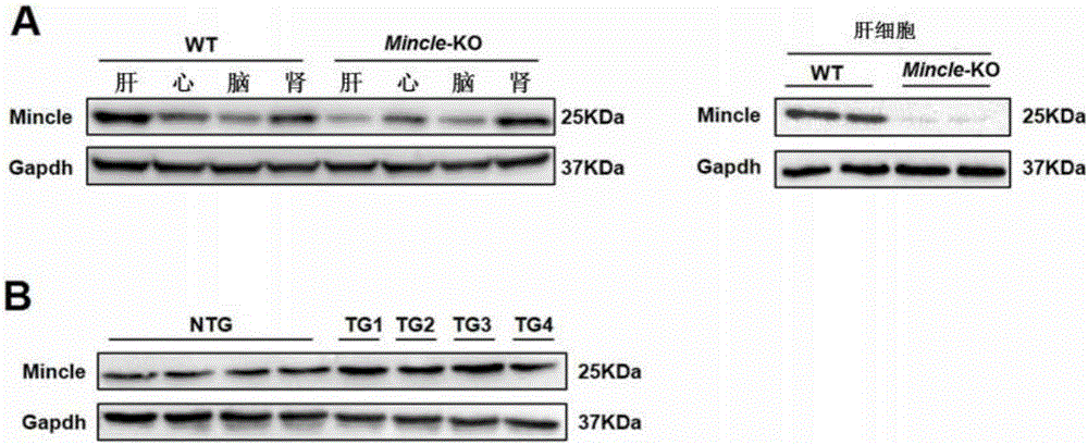 Application of Mincle and inhibitor thereof in hepatic ischemia reperfusion injuries