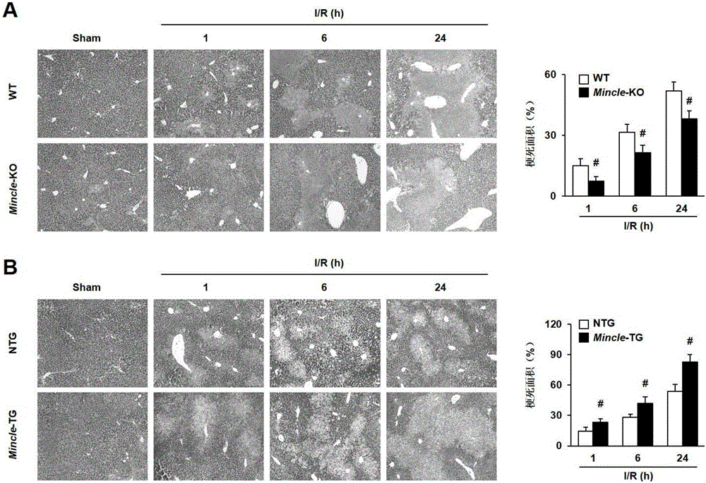 Application of Mincle and inhibitor thereof in hepatic ischemia reperfusion injuries