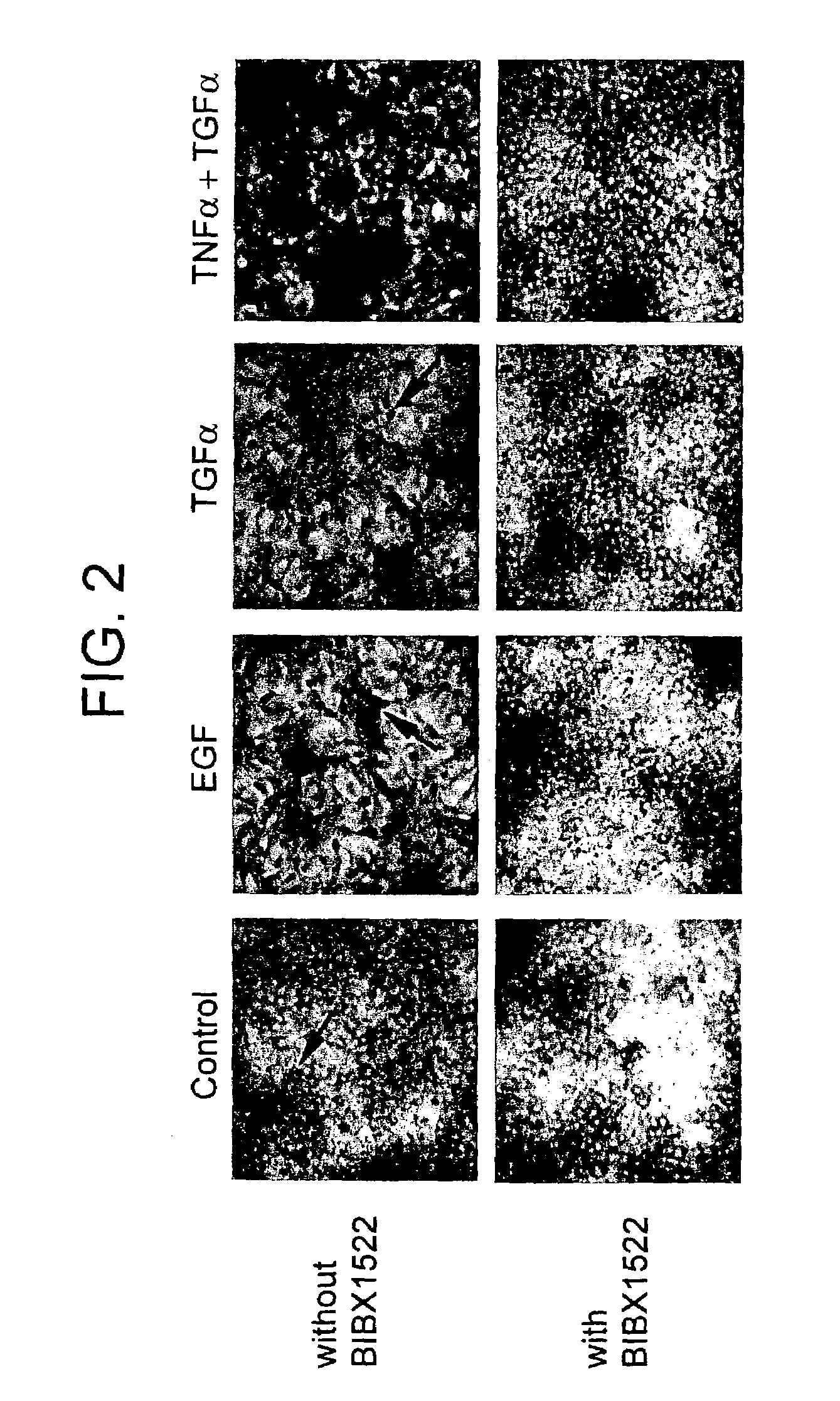 Preventing airway mucus production by administration of EGF-R antagonists