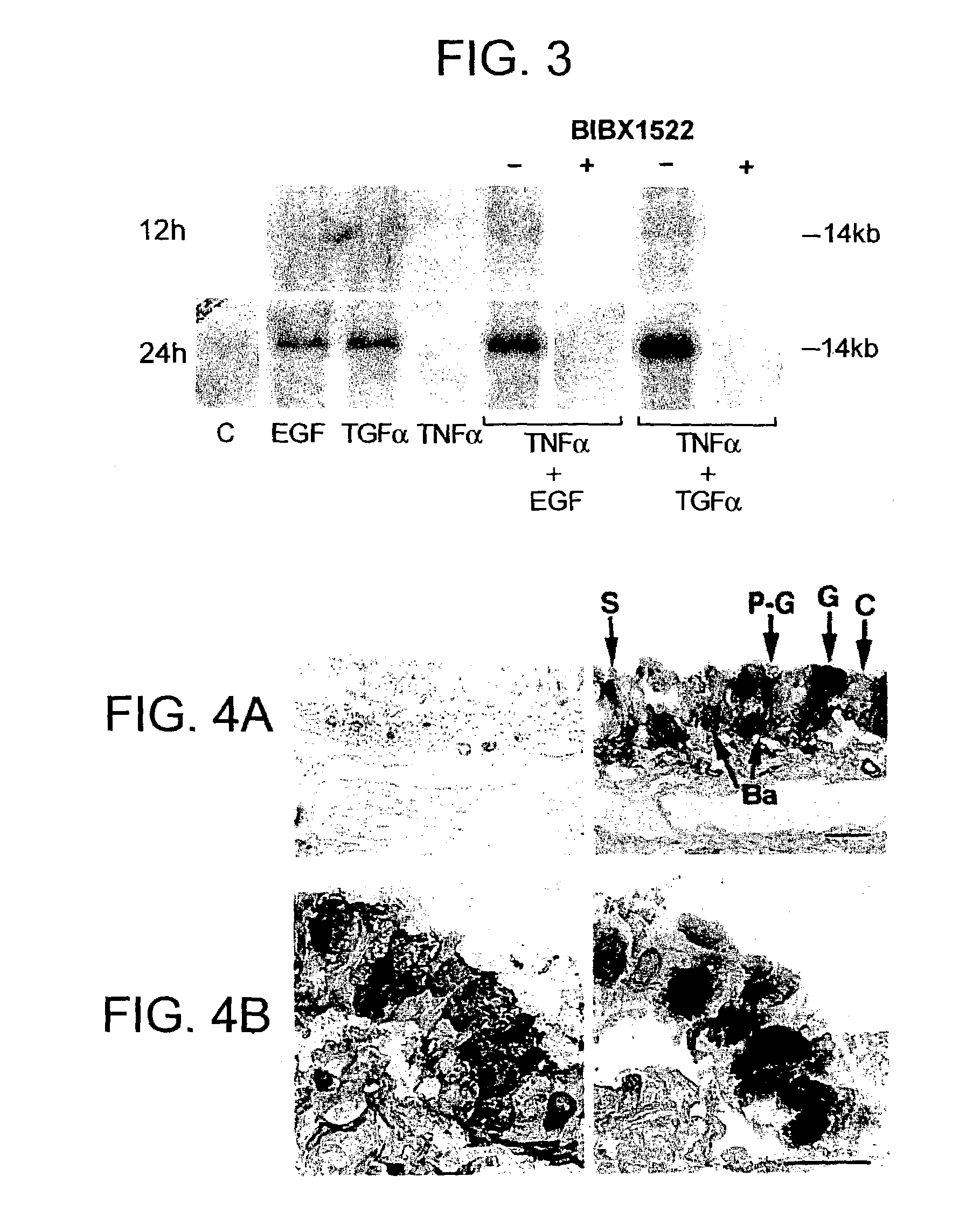 Preventing airway mucus production by administration of EGF-R antagonists