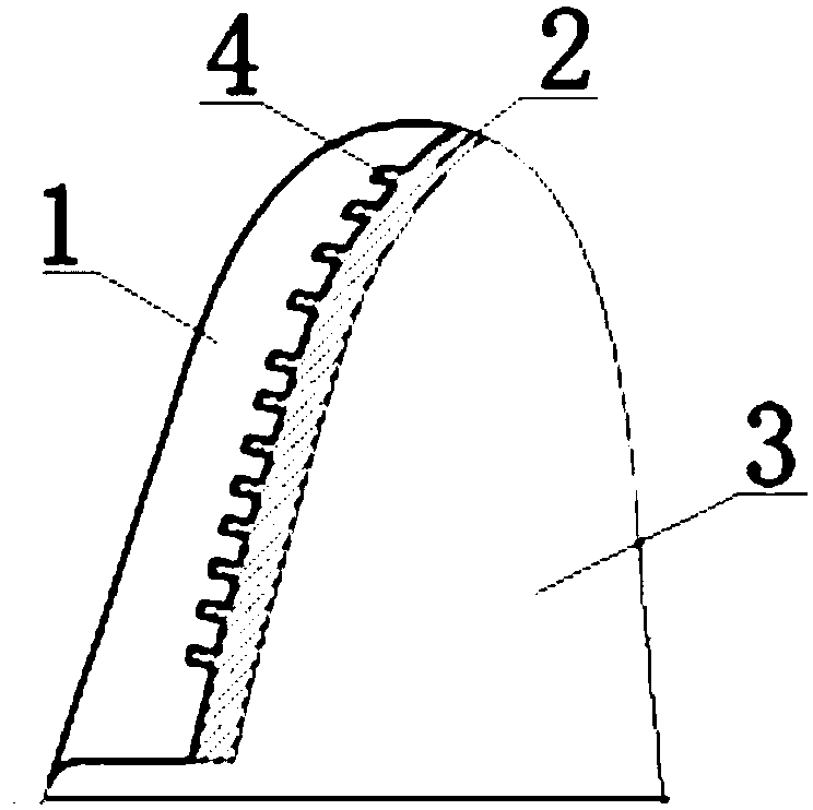 Color-masking zirconia veneer